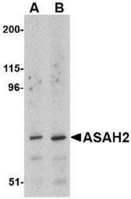Western Blot ASAH2/N-acylsphingosine Amidohydrolase-2 Antibody - BSA Free