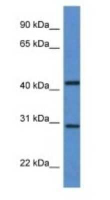 Western Blot ASAH3 Antibody - BSA Free