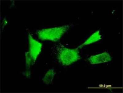 Immunocytochemistry/Immunofluorescence: ASAHL/N-acylethanolamine-hydrolyzing Acid Amidase Antibody (5E3) [H00027163-M01] - Analysis of monoclonal antibody to NAAA on NIH/3T3 cell. Antibody concentration 10 ug/ml.