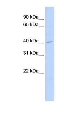 Western Blot: ASAHL/N-acylethanolamine-hydrolyzing Acid Amidase Antibody [NBP1-62534] - 721_B cell lysate, concentration 0.2-1 ug/ml.