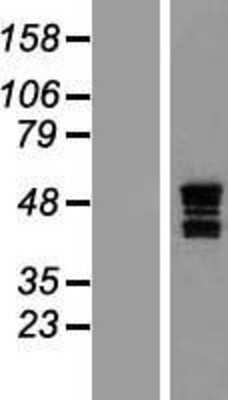 Western Blot: ASAHL/N-acylethanolamine-hydrolyzing Acid Amidase Overexpression Lysate [NBP2-10321] -  Left-Empty vector transfected control cell lysate (HEK293 cell lysate); Right -Over-expression Lysate for ASAHL.