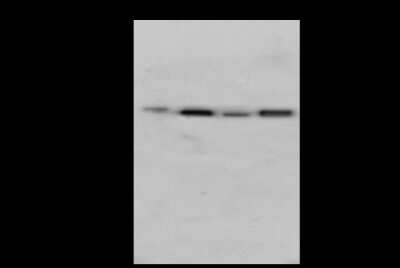 Western Blot: ASAM Antibody [NBP2-98301] - Anti-ASAM rabbit polyclonal antibody at 1:500 dilution. Lane A: HepG2 Whole Cell Lysate. Lane B: Mouse Stomach tissue Lysate. Lane C: Mouse Pancreas tissue Lysate. Lane D: Mouse Brain tissue lysate. Lysates/proteins at 30 ug per lane. Secondary Goat Anti-Rabbit IgG (H+L)/HRP at 1/10000 dilution. Developed using the ECL technique. Performed under reducing conditions. Predicted band size: 41 kDa. Observed band size: 45 kDa