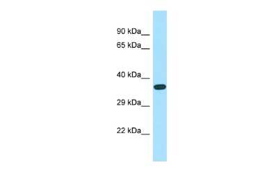 Western Blot: ASB-14 Antibody [NBP3-09563] - Western blot analysis of ASB-14 in Fetal Heart as a positive control. Antibody dilution at 1.0 ug/ml