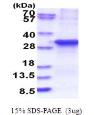 SDS-Page: ASB13 Recombinant Protein [NBP2-51796] - 15% SDS Page (3 ug)