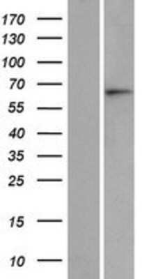 Western Blot: ASB15 Overexpression Lysate (Adult Normal) [NBP2-05744] Left-Empty vector transfected control cell lysate (HEK293 cell lysate); Right -Over-expression Lysate for ASB15.