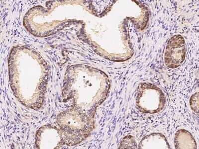Immunohistochemistry-Paraffin: ASB2 Antibody [NBP2-98774] - Staining of human ASB2 in human pancreas with rabbit polyclonal antibody (1:2000).
