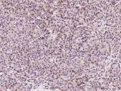 Immunohistochemistry-Paraffin: ASB2 Antibody [NBP2-98774] - Staining of human ASB2 in human prostate with rabbit polyclonal antibody (1:2000).
