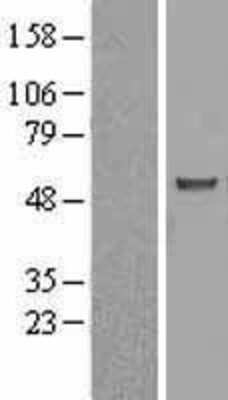 Western Blot: ASB3 Overexpression Lysate (Adult Normal) [NBL1-07750] Left-Empty vector transfected control cell lysate (HEK293 cell lysate); Right -Over-expression Lysate for ASB3.