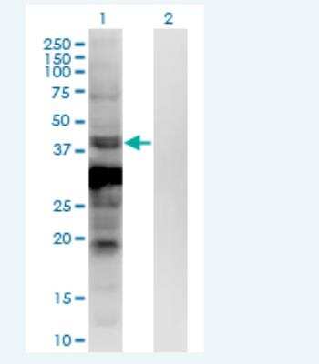 Western Blot: ASB5 Antibody (6B10) [H00140458-M03-100ug] -  Analysis of ASB5 expression in transfected 293T cell line by ASB5 monoclonal antibody (M03), clone 6B10.  Lane 1: ASB5 transfected lysate (Predicted MW: 36.3 KDa). Lane 2: Non-transfected lysate.