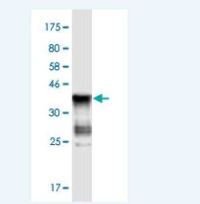 Western Blot ASB5 Antibody (6B10) - Azide and BSA Free