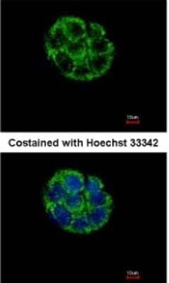 Immunocytochemistry/Immunofluorescence: ASB5 Antibody [NBP1-32603] - Analysis of methanol-fixed Hep G2, using antibody at 1:500 dilution.
