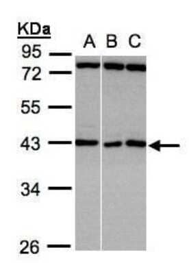 Western Blot: ASB5 Antibody [NBP1-32603] - (30 ug whole cell lysate) A:A431 B:HeLa S3 C:Hep G2 10% SDS PAGE diluted at 1:1000