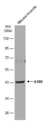 Western Blot ASB5 Antibody - BSA Free