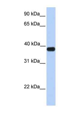 Western Blot: ASB5 Antibody [NBP1-59065] - Human Muscle lysate, concentration 0.2-1 ug/ml.