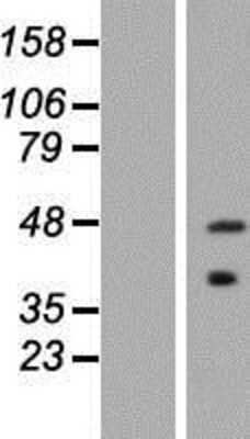 Western Blot ASB5 Overexpression Lysate
