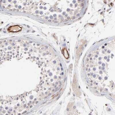 Immunohistochemistry-Paraffin ASB7 Antibody - BSA Free