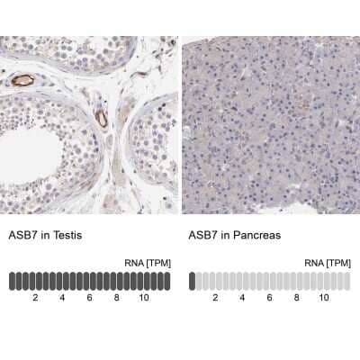Immunohistochemistry-Paraffin ASB7 Antibody - BSA Free