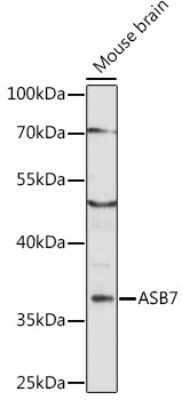 Western Blot: ASB7 Antibody [NBP2-92332] - Analysis of extracts of mouse brain, using ASB7 .Exposure time: 30s.