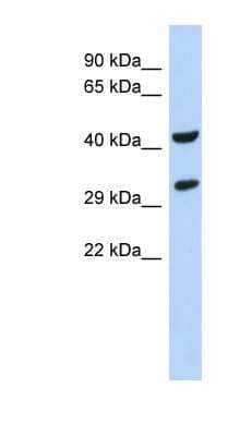 Western Blot: ASB8 Antibody [NBP1-58904] - Human Pancrease lysate, concentration 0.2-1 ug/ml.