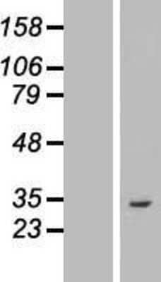 Western Blot: ASB8 Overexpression Lysate (Adult Normal) [NBL1-07755] Left-Empty vector transfected control cell lysate (HEK293 cell lysate); Right -Over-expression Lysate for ASB8.