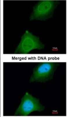 Immunocytochemistry/Immunofluorescence: ASB9 Antibody [NBP1-32541] - Paraformaldehyde-fixed HeLa, using antibody at 1:200 dilution.