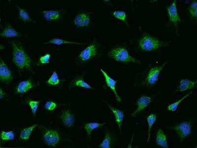 Immunocytochemistry/Immunofluorescence: ASB9 Antibody [NBP2-98662] - Immunofluorescence staining of ASB9 in Hela cells. Cells were fixed with 4% PFA, permeabilzed with 0.1% Triton X-100 in PBS, blocked with 10% serum, and incubated with rabbit anti-Human ASB9 polyclonal antibody (dilution ratio 1:200) at 4C overnight. Then cells were stained with the Alexa Fluor(R)488-conjugated Goat Anti-rabbit IgG secondary antibody (green) and counterstained with DAPI (blue).Positive staining was localized to Cytoplasm.