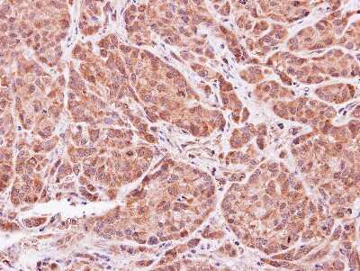 Immunohistochemistry-Paraffin: ASB9 Antibody [NBP1-32541] - Paraffin-embedded A549 xenograft, using antibody at 1:500 dilution.