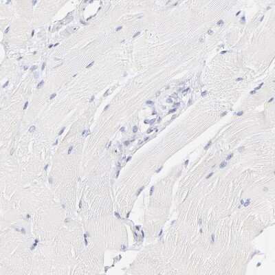 Immunohistochemistry-Paraffin: ASB9 Antibody [NBP1-85081] - Staining of human skeletal muscle shows no positivity in myocytes as expected.