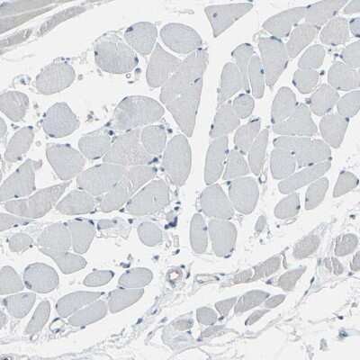 Immunohistochemistry-Paraffin: ASB9 Antibody [NBP1-85082] - Staining of human skeletal muscle shows no positivity in myocytes as expected.