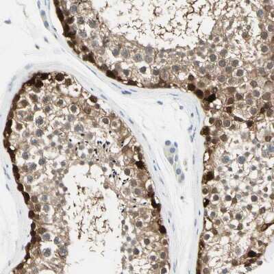 Immunohistochemistry-Paraffin: ASB9 Antibody [NBP1-85082] - Staining of human testis shows strong membranous positivity in cells in seminiferous ducts.