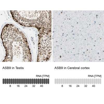 Immunohistochemistry-Paraffin: ASB9 Antibody [NBP1-85082] - Analysis in human testis and cerebral cortex tissues using NBP1-85082 antibody. Corresponding ASB9 RNA-seq data are presented for the same tissues.
