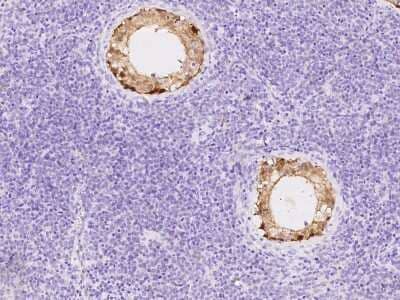 Immunohistochemistry-Paraffin: ASB9 Antibody [NBP2-98662] - Immunochemical staining of human ASB9 in human testis with rabbit polyclonal antibody at 1:1000 dilution, formalin-fixed paraffin embedded sections.