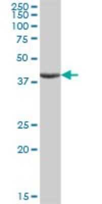 Western Blot: ASB9 Antibody [H00140462-B01P] - Analysis of ASB9 expression in human liver.