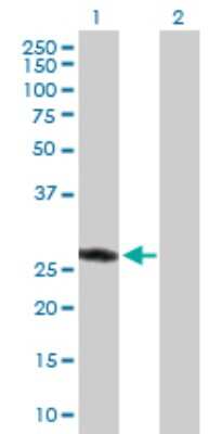 Western Blot: ASB9 Antibody [H00140462-D01P] - Analysis of ASB9 expression in transfected 293T cell line by ASB9 polyclonal antibody.Lane 1: ASB9 transfected lysate(31.90 KDa).Lane 2: Non-transfected lysate.