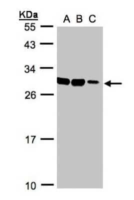 Western Blot: ASB9 Antibody [NBP1-32541] - Sample(30 ug whole cell lysate)A:HeLa S3 B:Hep G2 C:MOLT4  12% SDS PAGE, antibody diluted at 1:1000.