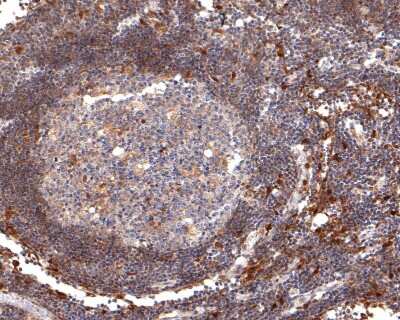 Immunohistochemistry-Paraffin: ASC/TMS1 Antibody (SN07-10) [NBP2-67697] - Analysis of paraffin-embedded human lymph nodes tissue with Rabbit anti-ASC/TMS1 antibody washed with ddH2O and PBS, and then probed with the primary antibody at 1/400 dilution for 1 hour at room temperature. The detection was performed using an HRP conjugated compact polymer system. DAB was used as the chromogen. Tissues were counterstained with hematoxylin and mounted with DPX.