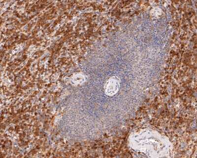 Immunohistochemistry-Paraffin: ASC/TMS1 Antibody (SN07-10) [NBP2-67697] - Analysis of paraffin-embedded human spleen tissue with Rabbit anti-ASC/TMS1 antibody washed with ddH2O and PBS, and then probed with the primary antibody at 1/400 dilution for 1 hour at room temperature. The detection was performed using an HRP conjugated compact polymer system. DAB was used as the chromogen. Tissues were counterstained with hematoxylin and mounted with DPX.