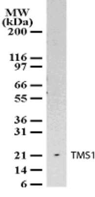 Western Blot: ASC/TMS1 Antibody [NB100-56365] - Analysis for ASC/TMS1 using NB100-56365 at 2 ug/ml against 10 ug/lane of A549 cell lysate.