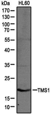 Western Blot: ASC/TMS1 Antibody [NB100-56365] - Analysis of extracts from HL60 cells using ASC/TMS1 antibody (NB100-56365) at 1:1000 (0.5ug/ml).