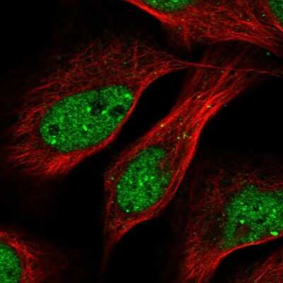 Immunocytochemistry/Immunofluorescence: ASC1 Antibody [NBP2-58194] - Staining of human cell line U-2 OS shows localization to nucleoplasm & nuclear bodies.