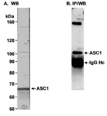 Western Blot: ASC1 Antibody [NB100-419] - Detection of human ASC1 in Western Blot and immunoprecipitation, using NB100-419. Immunoprecipitated ASC1 was detected using an antibody to a distinctly different epitope on ASC1.