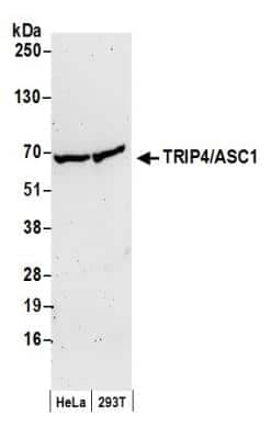 Western Blot ASC1 Antibody