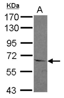 Western Blot: ASC1 Antibody [NBP2-15486] - Sample (30 ug of whole cell lysate) A: A549 7. 5% SDS PAGE gel, diluted at 1:1000.