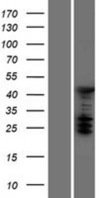 Western Blot ASC1 Overexpression Lysate