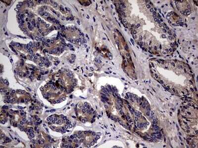 Immunohistochemistry: ASC2 Antibody (9C10) [NBP2-45495] - Analysis of Human prostate tissue. (Heat-induced epitope retrieval by 1 mM EDTA in 10mM Tris, pH8.5, 120C for 3min)