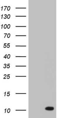 Western Blot: ASC2 Antibody (9C10) [NBP2-45495] - Analysis of HEK293T cells were transfected with the pCMV6-ENTRY control (Left lane) or pCMV6-ENTRY ASC2.