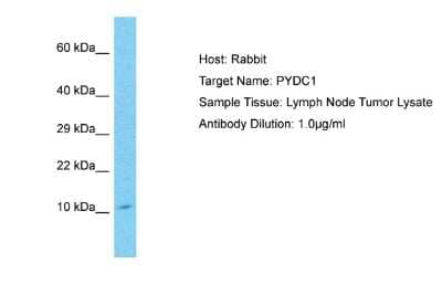 Western Blot: ASC2 Antibody [NBP2-86581] - Host: Rabbit. Target Name: PYDC1. Sample Type: Lymph Node Tumor lysates. Antibody Dilution: 1.0ug/ml