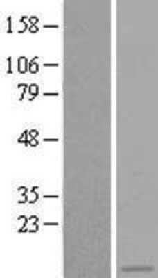 Western Blot: ASC2 Overexpression Lysate (Adult Normal) [NBL1-15020] Left-Empty vector transfected control cell lysate (HEK293 cell lysate); Right -Over-expression Lysate for ASC2.