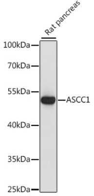 Western Blot ASCC1 Antibody - Azide and BSA Free