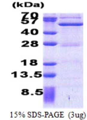 SDS-PAGE Recombinant Human ASCC1 His Protein